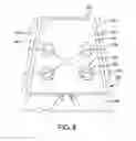 Fig. 07 - Prosthetic heart valve with retention elements
