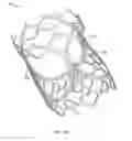 Fig. 03 - Collapsible prosthetic heart valves
