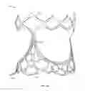 Fig. 04 - Collapsible prosthetic heart valves