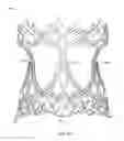 Fig. 05 - Collapsible prosthetic heart valves