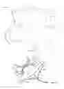 Fig. 13 - Collapsible prosthetic heart valves