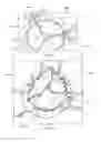 Fig. 15 - Collapsible prosthetic heart valves