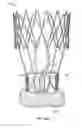 Fig. 34 - Collapsible prosthetic heart valves