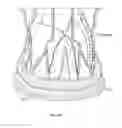 Fig. 42 - Collapsible prosthetic heart valves