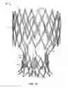 Fig. 48 - Collapsible prosthetic heart valves