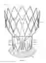 Fig. 51 - Collapsible prosthetic heart valves