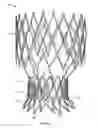 Fig. 57 - Collapsible prosthetic heart valves