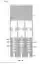 Fig. 62 - Collapsible prosthetic heart valves