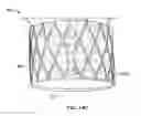 Fig. 66 - Collapsible prosthetic heart valves