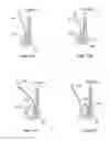 Fig. 68 - Collapsible prosthetic heart valves