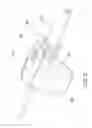 Fig. 22 - Methods and apparatuses for deploying minimally-invasive heart valves