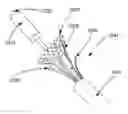 Fig. 01 - Heart valve assistive prosthesis