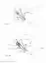 Fig. 10 - Heart valve assistive prosthesis