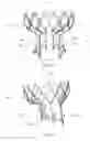Fig. 17 - Heart valve assistive prosthesis