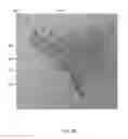 Fig. 19 - Heart valve assistive prosthesis