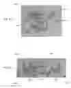 Fig. 23 - Heart valve assistive prosthesis