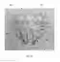 Fig. 25 - Heart valve assistive prosthesis