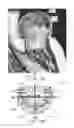 Fig. 27 - Heart valve assistive prosthesis