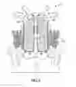 Fig. 07 - Shapeable porous metal implant