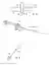 Fig. 23 - Spine stabilization device, and method and kit for its implantation