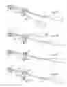 Fig. 24 - Spine stabilization device, and method and kit for its implantation