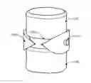 Fig. 01 - Interbody fusion device