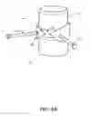 Fig. 05 - Interbody fusion device