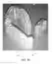 Fig. 30 - IBD Expandable Ti