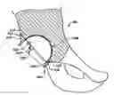 Fig. 01 - Devices and methods for hip replacement