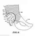 Fig. 08 - Devices and methods for hip replacement