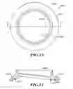 Fig. 11 - Devices and methods for hip replacement