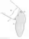 Fig. 01 - METHODS FOR PREPARING PRECISELY FITTED CASTS for PROSTHETICS