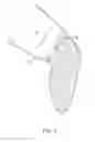 Fig. 02 - METHODS FOR PREPARING PRECISELY FITTED CASTS for PROSTHETICS
