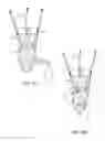 Fig. 06 - METHODS FOR PREPARING PRECISELY FITTED CASTS for PROSTHETICS