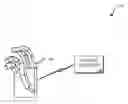 Fig. 01 - Systems and methods for postural control of a multi-function prosthesis