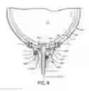 Fig. 09 - Rotatable prosthetic adapter