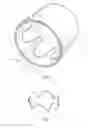 Fig. 05 - Low profile non-symmetrical stent