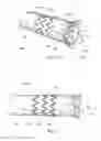 Fig. 09 - Low profile non-symmetrical stent