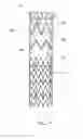 Fig. 12 - Low profile non-symmetrical stent