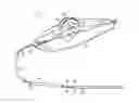 Fig. 01 - Thumbwheel actuated vascular intervention device delivery system