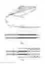 Fig. 02 - Thumbwheel actuated vascular intervention device delivery system