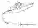 Fig. 01 - Thumbwheel actuated vascular intervention device delivery system