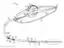Fig. 01 - Termination assembly for vascular intervention device delivery system