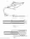 Fig. 02 - Termination assembly for vascular intervention device delivery system