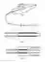 Fig. 02 - Ribbed handle for vascular intervention device delivery system