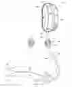 Fig. 01 - Restriction device