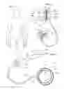Fig. 02 - Restriction device