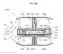 Fig. 12 - Restriction device