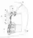 Fig. 01 - Thoracic lumbar sacral orthosis