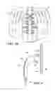 Fig. 04 - Thoracic lumbar sacral orthosis